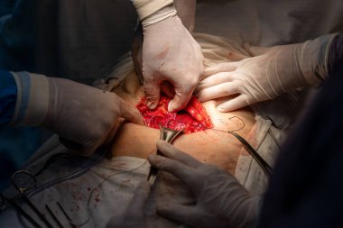 Bir grup cerrah bir hastaya ameliyat yapıyor. Cerrahlar görevlerine odaklandığı için sahne yoğun ve ciddi. Hasta çok acı çekiyor.