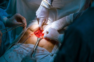 Bir grup cerrah bir hastaya ameliyat yapıyor. Cerrahlar görevlerine odaklandığı için sahne yoğun ve ciddi. Hasta masanın üzerinde yatıyor.