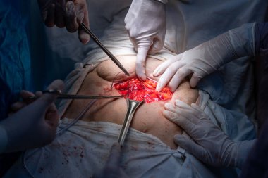 Bir grup cerrah bir hastaya ameliyat yapıyor. Cerrahlar görevlerine odaklandığı için sahne yoğun ve ciddi. Hasta çok acı çekiyor.