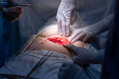 Bir cerrah bir insanın karnını deşiyor. Cerrah ve diğer tıp uzmanları hastanın hayatını kurtarmak için çalışırken sahne yoğun ve dramatik.