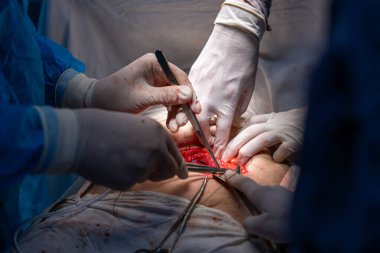 Bir grup cerrah bir hastaya ameliyat yapıyor. Cerrahlar görevlerine odaklandığı için sahne yoğun ve ciddi. Hasta masanın üzerinde yatıyor.