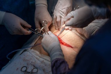 Bir grup cerrah bir hastaya ameliyat yapıyor. Cerrahlar görevlerine odaklandığı için sahne yoğun ve ciddi. Hasta çok acı çekiyor.