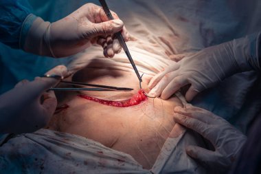 Bir grup cerrah bir hastaya ameliyat yapıyor. Cerrahlar görevlerine odaklandığı için sahne yoğun ve ciddi. Hasta çok acı çekiyor.