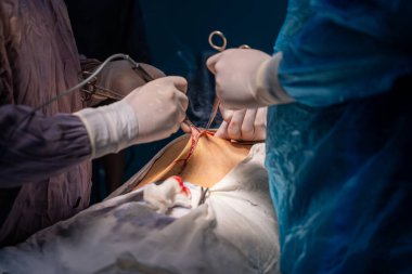 Bir grup cerrah bir hastaya ameliyat yapıyor. Cerrahlar görevlerine odaklandığı için sahne yoğun ve ciddi. Hasta masanın üzerinde yatıyor.