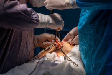 Bir grup cerrah bir hastaya ameliyat yapıyor. Olay yeri ciddi ve odaklı. Cerrahlar hastanın hayatını kurtarmak için birlikte çalışıyorlar.