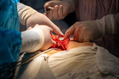 Bir grup cerrah bir hastaya ameliyat yapıyor. Cerrahlar görevlerine odaklandığı için sahne yoğun ve ciddi. Hasta savunmasız bir durumda.