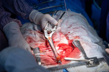 Hastane, cerrah, ameliyat, ameliyat, doktor, cerrahi, hasta, ilaç, kişi, hemşire, sağlık, takım çalışması, mide ameliyatı.