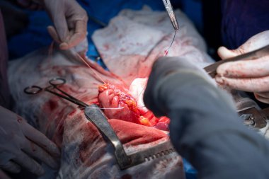 Hastane, cerrah, ameliyat, ameliyat, doktor, cerrahi, hasta, ilaç, kişi, hemşire, sağlık, takım çalışması, mide ameliyatı.