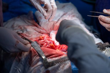 Hastane, cerrah, ameliyat, ameliyat, doktor, cerrahi, hasta, ilaç, kişi, hemşire, sağlık, takım çalışması, mide ameliyatı.