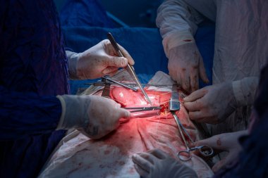 Hastane, cerrah, ameliyat, ameliyat, doktor, cerrahi, hasta, ilaç, kişi, hemşire, sağlık, takım çalışması, mide ameliyatı.