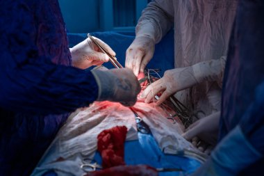 Hastane, cerrah, ameliyat, ameliyat, doktor, cerrahi, hasta, ilaç, kişi, hemşire, sağlık, takım çalışması, mide ameliyatı.