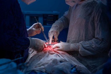 Hastane, cerrah, ameliyat, ameliyat, doktor, cerrahi, hasta, ilaç, kişi, hemşire, sağlık, takım çalışması, mide ameliyatı.