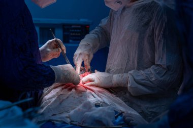 Hastane, cerrah, ameliyat, ameliyat, doktor, cerrahi, hasta, ilaç, kişi, hemşire, sağlık, takım çalışması, mide ameliyatı.