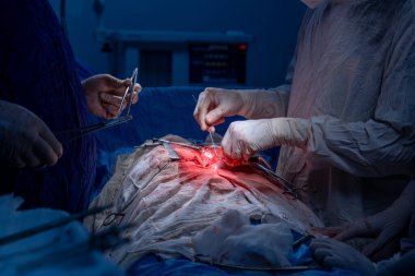 Hastane, cerrah, ameliyat, ameliyat, doktor, cerrahi, hasta, ilaç, kişi, hemşire, sağlık, takım çalışması, mide ameliyatı.