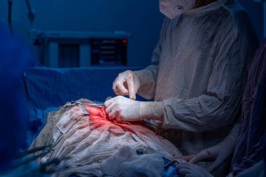 Hastane, cerrah, ameliyat, ameliyat, doktor, cerrahi, hasta, ilaç, kişi, hemşire, sağlık, takım çalışması, mide ameliyatı.