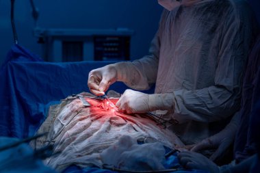 Hastane, cerrah, ameliyat, ameliyat, doktor, cerrahi, hasta, ilaç, kişi, hemşire, sağlık, takım çalışması, mide ameliyatı.