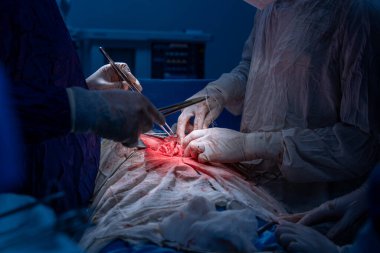 Hastane, cerrah, ameliyat, ameliyat, doktor, cerrahi, hasta, ilaç, kişi, hemşire, sağlık, takım çalışması, mide ameliyatı.