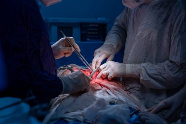 Hastane, cerrah, ameliyat, ameliyat, doktor, cerrahi, hasta, ilaç, kişi, hemşire, sağlık, takım çalışması, mide ameliyatı.