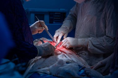 Hastane, cerrah, ameliyat, ameliyat, doktor, cerrahi, hasta, ilaç, kişi, hemşire, sağlık, takım çalışması, mide ameliyatı.