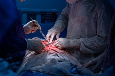 Hastane, cerrah, ameliyat, ameliyat, doktor, cerrahi, hasta, ilaç, kişi, hemşire, sağlık, takım çalışması, mide ameliyatı.