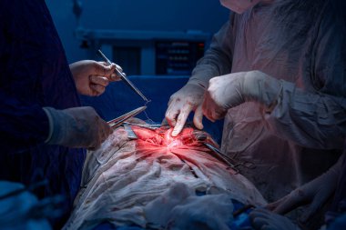 Hastane, cerrah, ameliyat, ameliyat, doktor, cerrahi, hasta, ilaç, kişi, hemşire, sağlık, takım çalışması, mide ameliyatı.