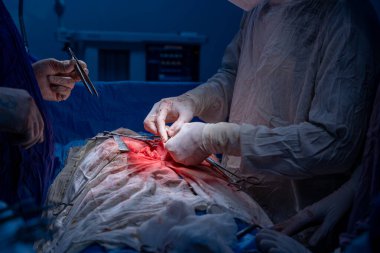 Hastane, cerrah, ameliyat, ameliyat, doktor, cerrahi, hasta, ilaç, kişi, hemşire, sağlık, takım çalışması, mide ameliyatı.