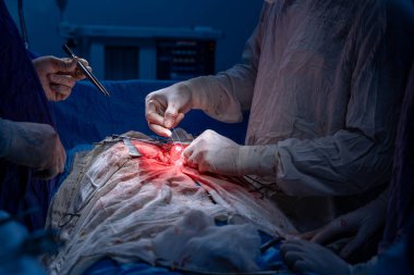 Hastane, cerrah, ameliyat, ameliyat, doktor, cerrahi, hasta, ilaç, kişi, hemşire, sağlık, takım çalışması, mide ameliyatı.