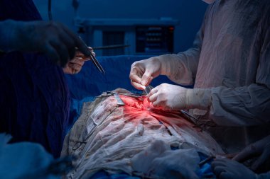 Hastane, cerrah, ameliyat, ameliyat, doktor, cerrahi, hasta, ilaç, kişi, hemşire, sağlık, takım çalışması, mide ameliyatı.