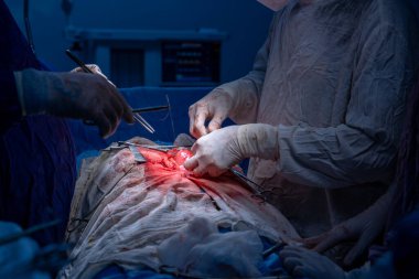 Hastane, cerrah, ameliyat, ameliyat, doktor, cerrahi, hasta, ilaç, kişi, hemşire, sağlık, takım çalışması, mide ameliyatı.