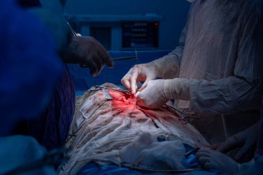 Hastane, cerrah, ameliyat, ameliyat, doktor, cerrahi, hasta, ilaç, kişi, hemşire, sağlık, takım çalışması, mide ameliyatı.