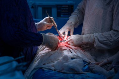 Hastane, cerrah, ameliyat, ameliyat, doktor, cerrahi, hasta, ilaç, kişi, hemşire, sağlık, takım çalışması, mide ameliyatı.