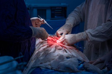 Hastane, cerrah, ameliyat, ameliyat, doktor, cerrahi, hasta, ilaç, kişi, hemşire, sağlık, takım çalışması, mide ameliyatı.