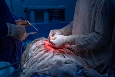 Hastane, cerrah, ameliyat, ameliyat, doktor, cerrahi, hasta, ilaç, kişi, hemşire, sağlık, takım çalışması, mide ameliyatı.