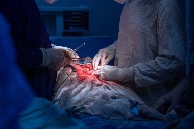 Hastane, cerrah, ameliyat, ameliyat, doktor, cerrahi, hasta, ilaç, kişi, hemşire, sağlık, takım çalışması, mide ameliyatı.