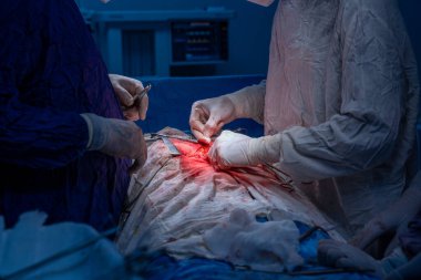 Hastane, cerrah, ameliyat, ameliyat, doktor, cerrahi, hasta, ilaç, kişi, hemşire, sağlık, takım çalışması, mide ameliyatı.