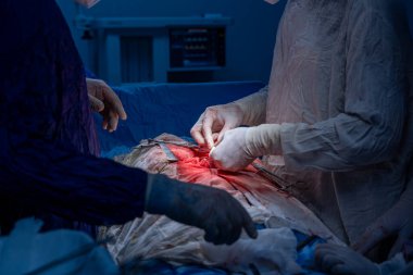 Hastane, cerrah, ameliyat, ameliyat, doktor, cerrahi, hasta, ilaç, kişi, hemşire, sağlık, takım çalışması, mide ameliyatı.