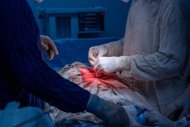 Hastane, cerrah, ameliyat, ameliyat, doktor, cerrahi, hasta, ilaç, kişi, hemşire, sağlık, takım çalışması, mide ameliyatı.