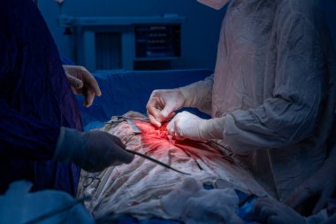 Hastane, cerrah, ameliyat, ameliyat, doktor, cerrahi, hasta, ilaç, kişi, hemşire, sağlık, takım çalışması, mide ameliyatı.