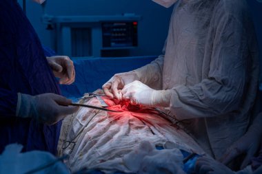 Hastane, cerrah, ameliyat, ameliyat, doktor, cerrahi, hasta, ilaç, kişi, hemşire, sağlık, takım çalışması, mide ameliyatı.