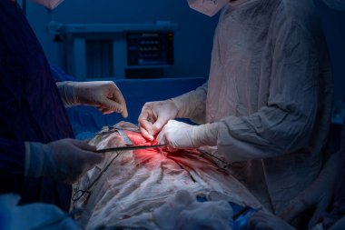 Hastane, cerrah, ameliyat, ameliyat, doktor, cerrahi, hasta, ilaç, kişi, hemşire, sağlık, takım çalışması, mide ameliyatı.