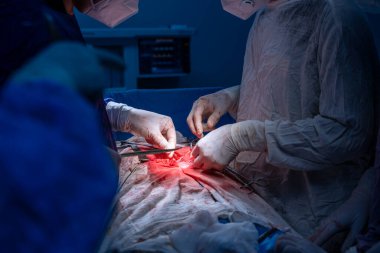 Hastane, cerrah, ameliyat, ameliyat, doktor, cerrahi, hasta, ilaç, kişi, hemşire, sağlık, takım çalışması, mide ameliyatı.