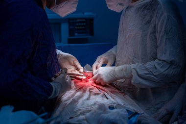 Hastane, cerrah, ameliyat, ameliyat, doktor, cerrahi, hasta, ilaç, kişi, hemşire, sağlık, takım çalışması, mide ameliyatı.