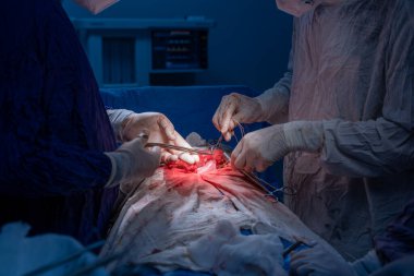 Hastane, cerrah, ameliyat, ameliyat, doktor, cerrahi, hasta, ilaç, kişi, hemşire, sağlık, takım çalışması, mide ameliyatı.