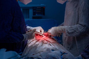 Hastane, cerrah, ameliyat, ameliyat, doktor, cerrahi, hasta, ilaç, kişi, hemşire, sağlık, takım çalışması, mide ameliyatı.