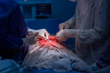 Hastane, cerrah, ameliyat, ameliyat, doktor, cerrahi, hasta, ilaç, kişi, hemşire, sağlık, takım çalışması, mide ameliyatı.