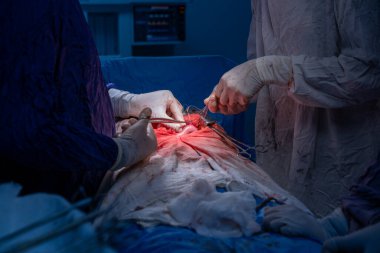 Hastane, cerrah, ameliyat, ameliyat, doktor, cerrahi, hasta, ilaç, kişi, hemşire, sağlık, takım çalışması, mide ameliyatı.