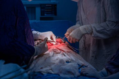 Hastane, cerrah, ameliyat, ameliyat, doktor, cerrahi, hasta, ilaç, kişi, hemşire, sağlık, takım çalışması, mide ameliyatı.