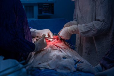 Hastane, cerrah, ameliyat, ameliyat, doktor, cerrahi, hasta, ilaç, kişi, hemşire, sağlık, takım çalışması, mide ameliyatı.