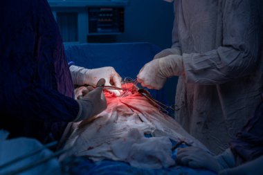 Hastane, cerrah, ameliyat, ameliyat, doktor, cerrahi, hasta, ilaç, kişi, hemşire, sağlık, takım çalışması, mide ameliyatı.