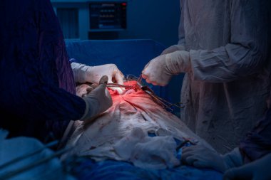 Hastane, cerrah, ameliyat, ameliyat, doktor, cerrahi, hasta, ilaç, kişi, hemşire, sağlık, takım çalışması, mide ameliyatı.